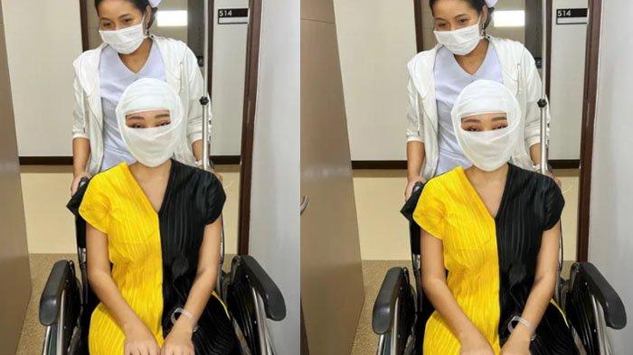 Lucinta Luna unggah foto wajah dibalut perban.