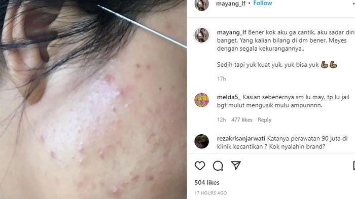 Mayang sedih wajahnya terus dihujat netizen