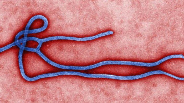 Mikrograf elektron dari virion virus Ebola
