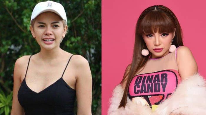 Nikita Mirzani dan Dinar Candy
