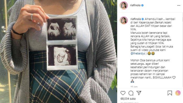 Nola Be3 umumkan hamil anak keempat