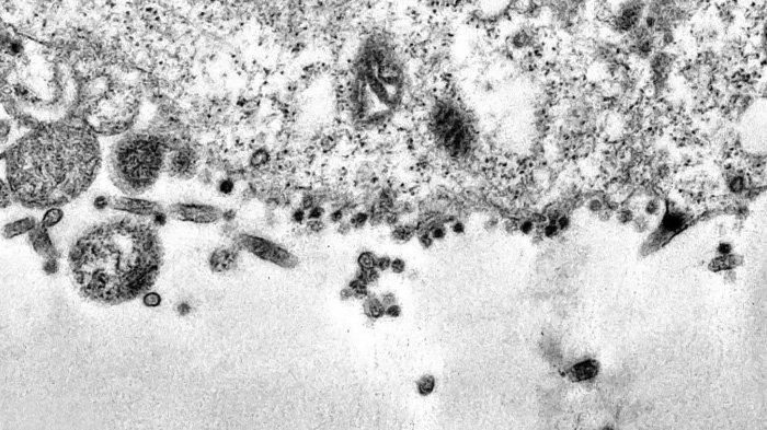 Virus corona