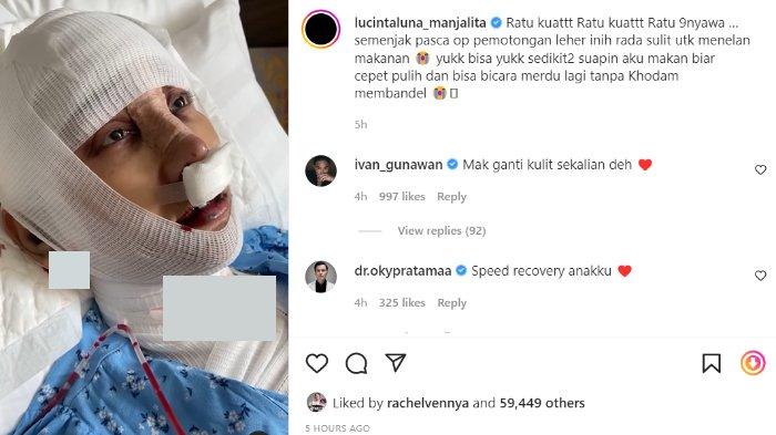 Wajah Lucinta Luna dipenuhi balutan perban.