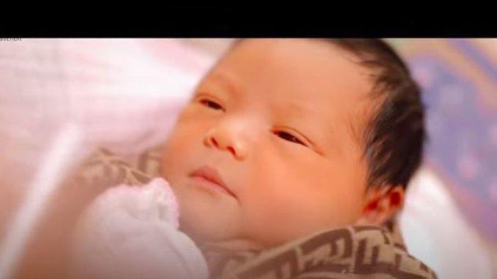 Baby A saat usia sehari.