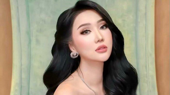 Lucinta Luna bersyukur sudah melakukan operasi tersebut,Diakui Lucinta Luna kalau wajahnya bengkak dan belum bisa makan, Selasa(11/7/2022).