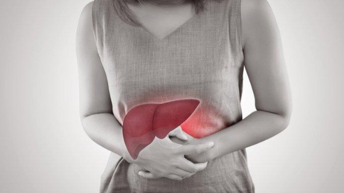 Ilustrasi hepatitis, khasiat temulawak untuk hepatitis B