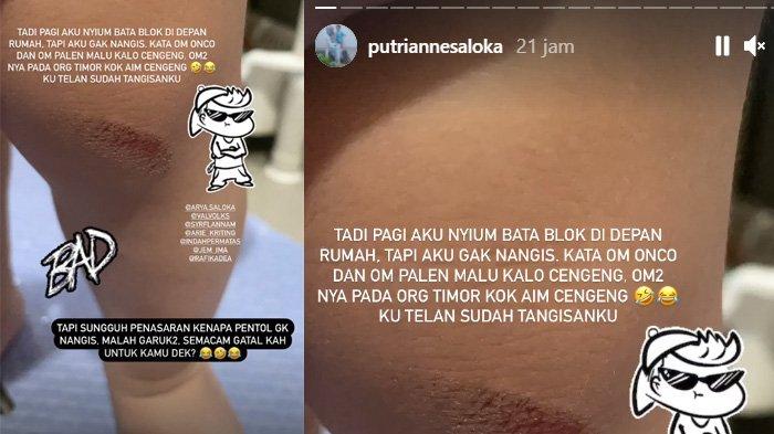 Instagram Story Putri Anne saat Ibrahim terjatuh