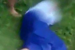 Operasi Pengangkatan Darah Beku Dalam Otak Korban Perundungan Siswa SD di Kepanjen