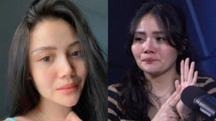 Mawar AFI cerita kondisi putra pertamanya.