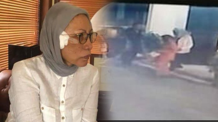 Ratna Sarumpaet Meminta Maaf, Ini Pengakuan Sebenarnya Soal Penganiayaan