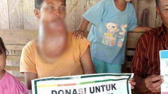 Kinem penderita kanker di Boyolali hanya dijanjikan mendapatkan bantuan.