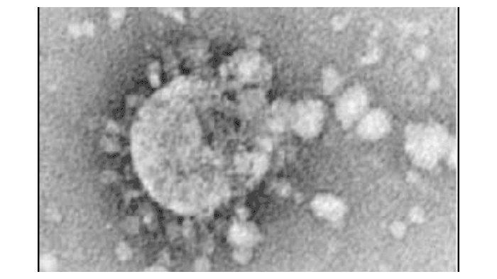 Penampakan-virus-corona-penyebab-SARS.jpg