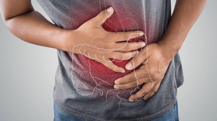 irritable-bowel-syndrome.jpg