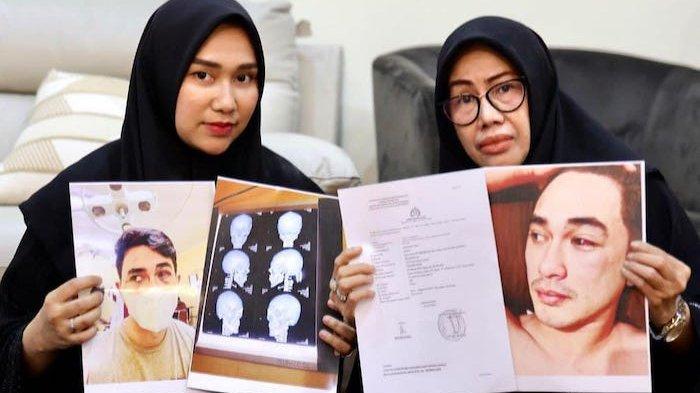 Istri Putra Siregar dan ibunda Rico Valentino tunjukan bukti pengeroyokan.