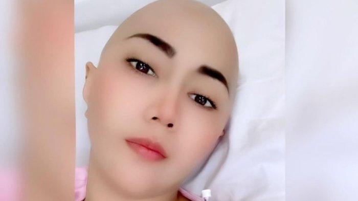 Penyanyi dangdut Aida Saskia terus berjuang melawan kanker payudara yang diidapnya sejak Oktober 2021. Foto Aida Saskia setelah menjalani kemoterapi ketiga, Kamis (12/5/2022).