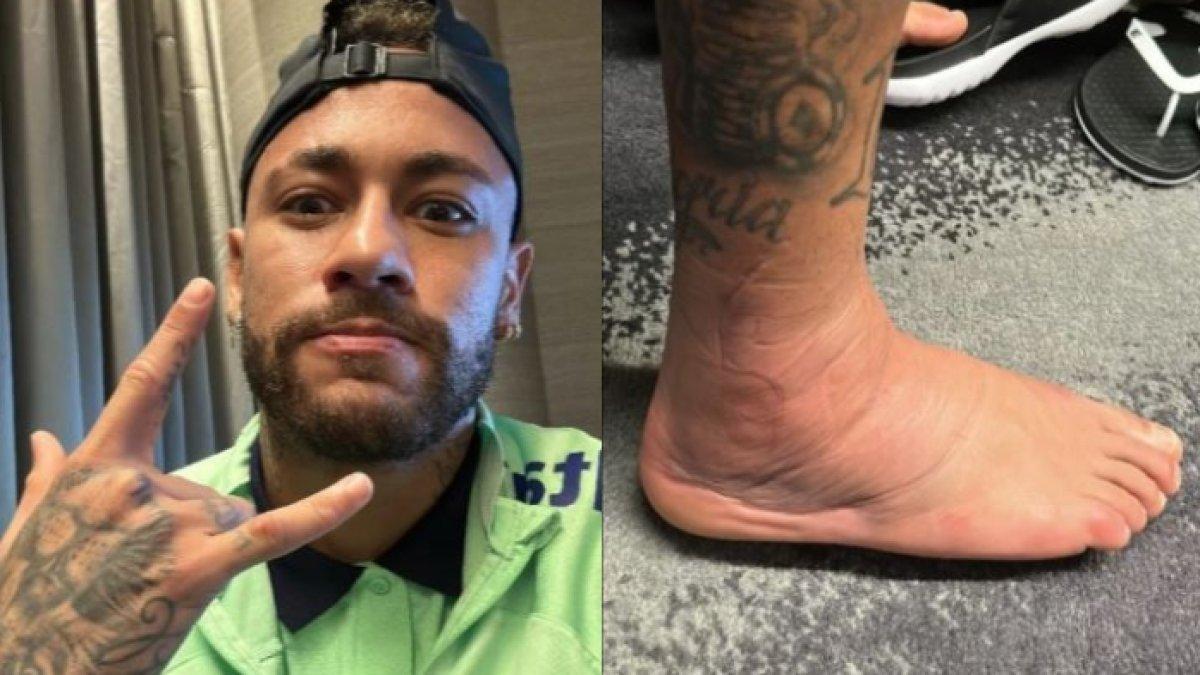 Penampakan cedera serius yang dialami Neymar Jr akibat dari tekel brutal pemain lawan saat Brasil Vs Serbia di Piala Dunia 2022 Qatar.