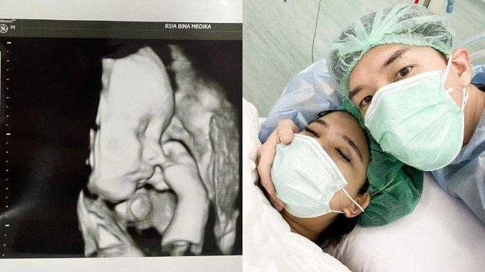 Kolase foto unggahan pengumuman Audi Marissa yang melahirkan anak pertama yang lahir secara prematur