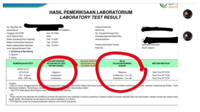 Hasil PCR Atta Halilintar yang sempat bersinggungan langsung dengan Aurel Hermansyah, Rabu (17/2/2021).