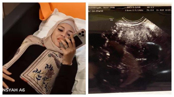 Kolase Aurel Hermansyah dan hali USG. Istri Atta Halilintar umumkan dirinya mengalami keguguran, Selasa (18/5/2021).